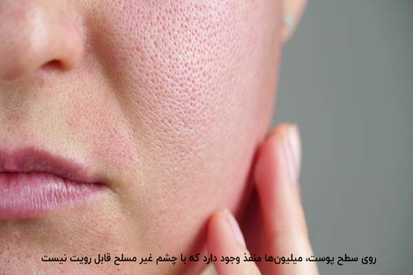 بهترین روش درمان منافذ باز پوست