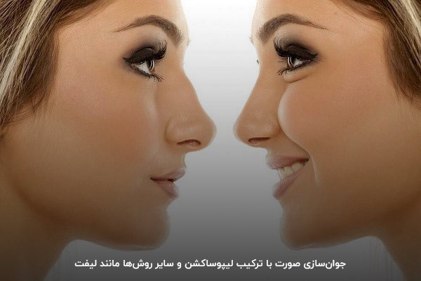 لیپوساکشن؛ روشی مطمئن و موثر برای اصلاح فرم صورت و بدن