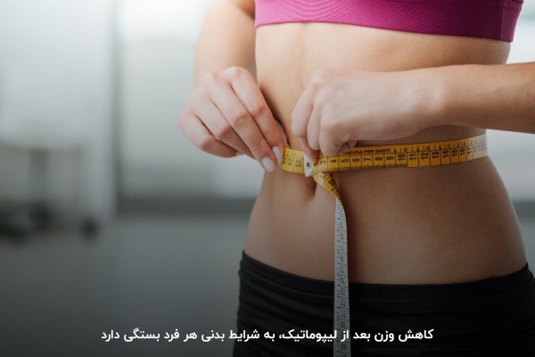 رعایت رژیم غذایی و ورزش موثر‌ترین عوامل میزان کاهش وزن بعد از لیپوماتیک 