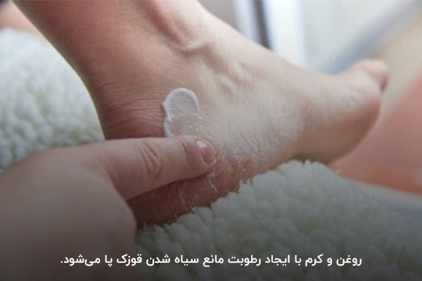 استفاده از روش‌های خانگی برای رفع سیاهی قوزک پا