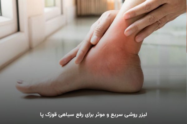 از بین بردن سیاهی قوزک پا با کمک دستگاه لیزر