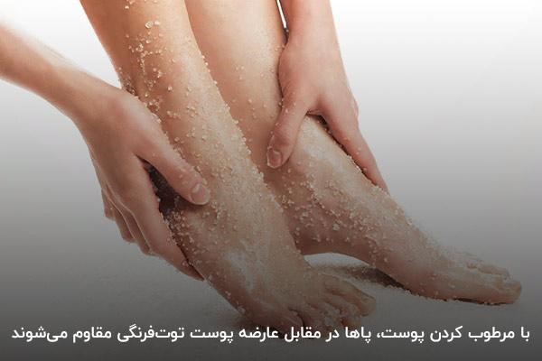 خشکی پوست، عامل تشدید کننده پای توت فرنگی