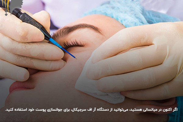 تقویت دور چشم؛ مرحله‌ای حساس در روتین پوستی روزانه