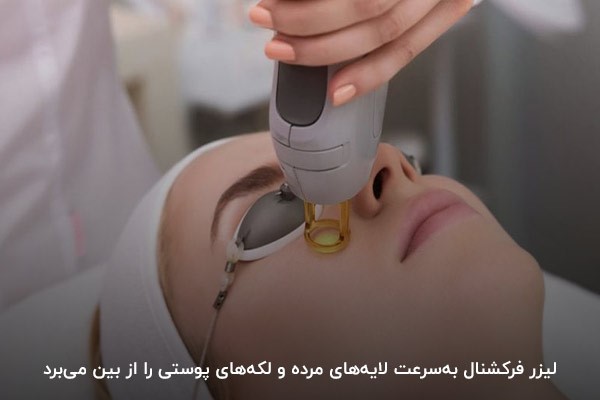کمک به افزایش گردش خون با لایه برداری پوست صورت