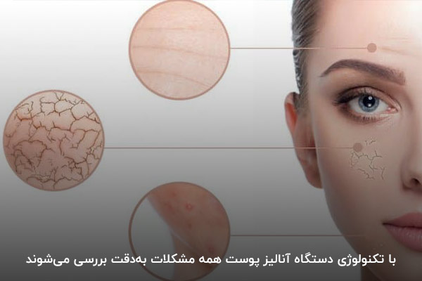 افزایش دقت در تشخیص و نحوه درمان با دستگاه آنالیز پوست
