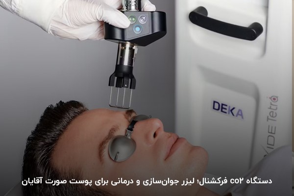 دستگاه co2 فرکشنال؛ لیزر جوان‌سازی و درمانی برای پوست صورت آقایان