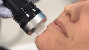 بهترین دستگاه آر اف فرکشنال | مقایسه قیمت و کارایی دستگاه‌ها - آفا طب