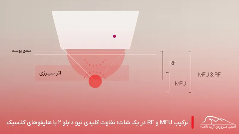 فرق نیو دابلو با هایفوهای کلاسیک چیست؟ - آفاطب
