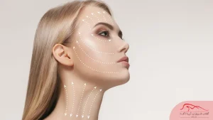 بررسی قوی‌ترین متدهای لیفتینگ دنیا - آفاطب
